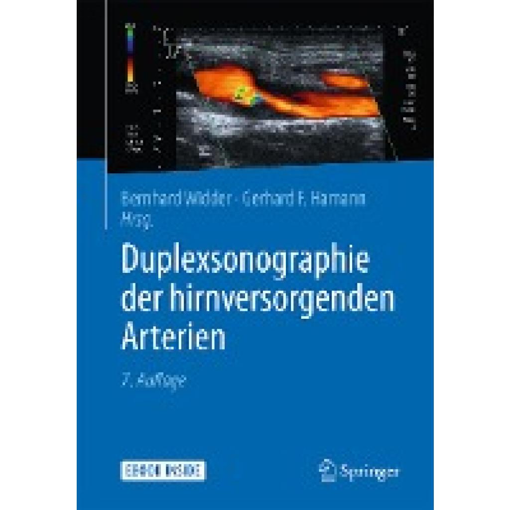 Duplexsonographie der hirnversorgenden Arterien